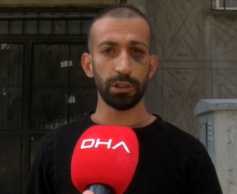 Taciz iddiasıyla sokak ortasında darbedildi: Fatura yüzünden iftira attılar