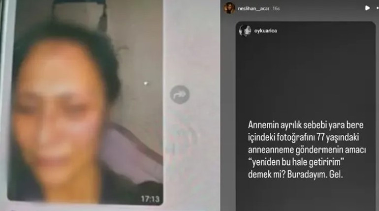 Kadir İnanır’ın miras tartışması büyüyor Levent İnanır’dan Neslihan Acar’ın iddialarına yanıt