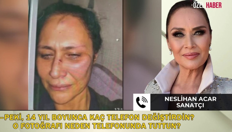 O fotoğraflar 14 yıl sonra neden oraya çıktı Neslihan Acardan çarpıcı açıklamalar