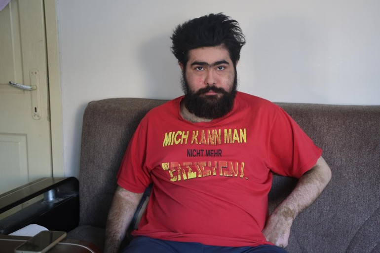 Hayat hikayesi ile Türkiyenin dikkatini çeken Barışın son hali şaşırttı: En son ne zaman duş aldığımı hatırlamıyorum