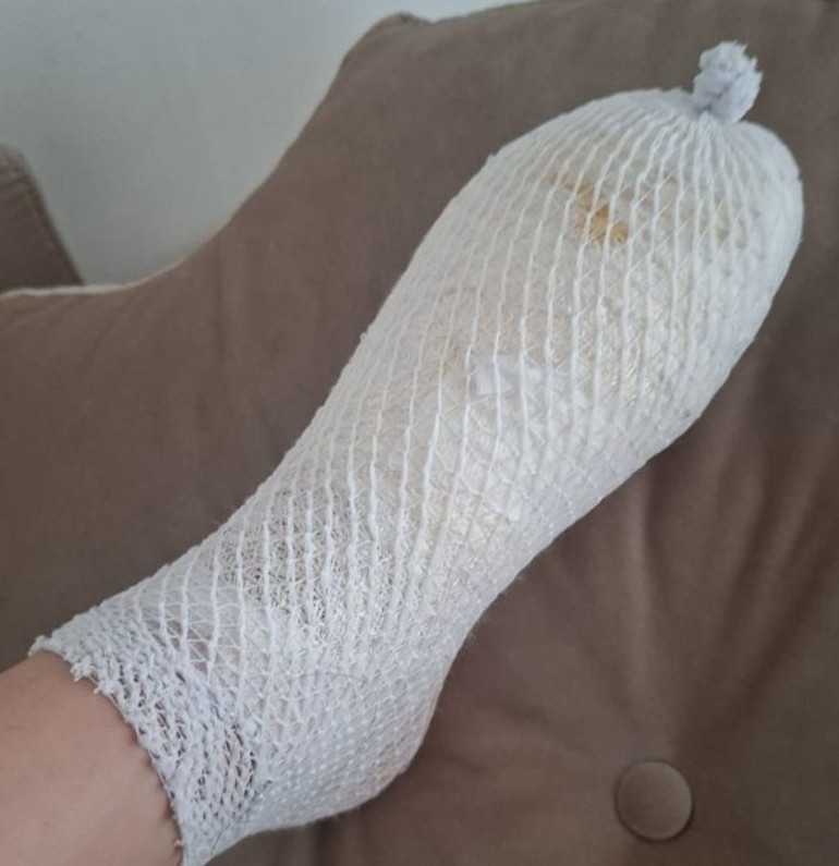 AVMden alınan oyuncak Furkanın elinde patladı: Aile suç duyurusunda bulundu | Odasından dehşet verici bir sesle seslendi