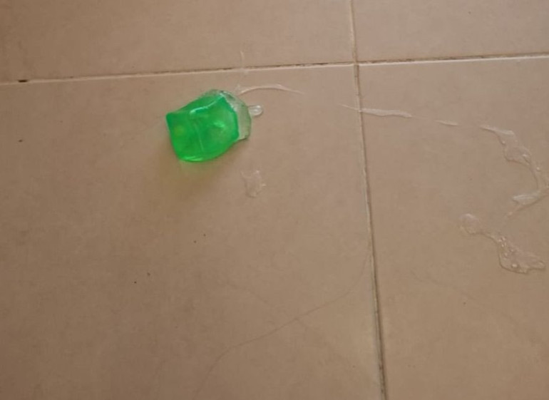 AVMden alınan oyuncak Furkanın elinde patladı: Aile suç duyurusunda bulundu | Odasından dehşet verici bir sesle seslendi