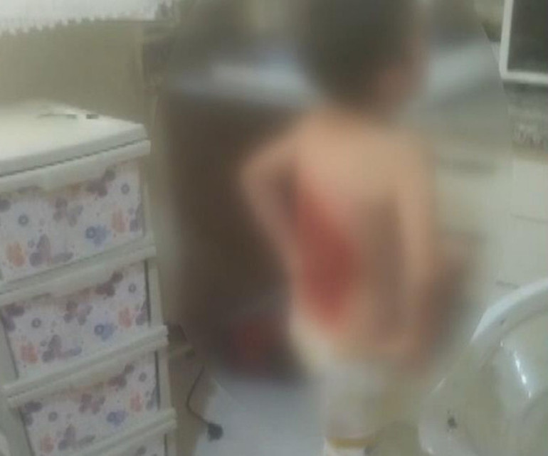 Arnavutköyde akran vahşeti: Arkadaşları kolonya döküp yaktı, 12 yaşındaki çocuk hastanelik oldu