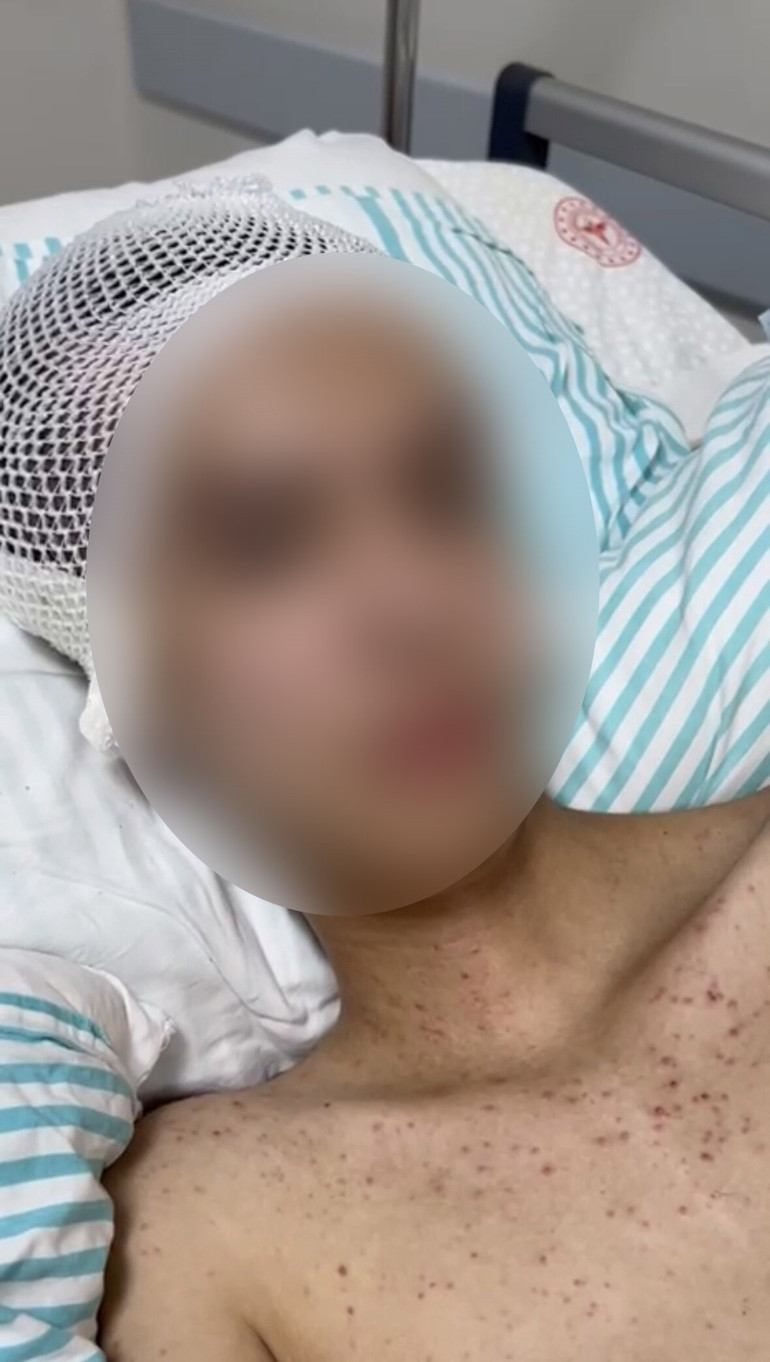 Komadan uyanıp gerçeği anlattı: Tacize direnince başından vurmuş… Solak çocuğun sağ elinde silah çıktı