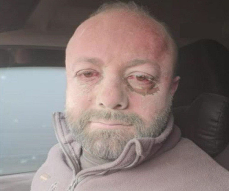 İç Anadoludaki kum fırtınasının perde arkası! 1950lere geri mi dönüyoruz? İç Anadoludaki kum fırtınasının perde arkası! 1950lere geri mi dönüyoruz?