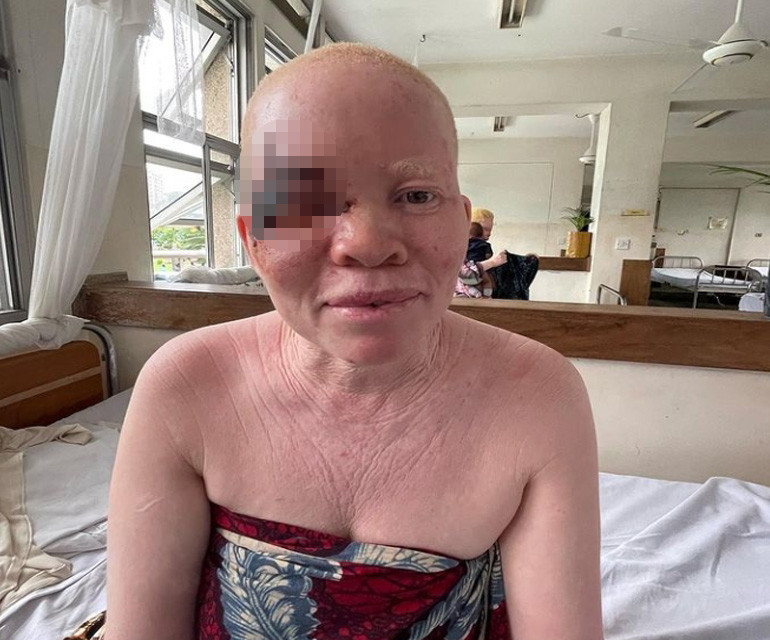 Siyah ülkenin lanetli beyazları! Ve Afrikanın Türk Annesi... Siyah ülkenin lanetli beyazları! Ve Afrikanın Türk Annesi...