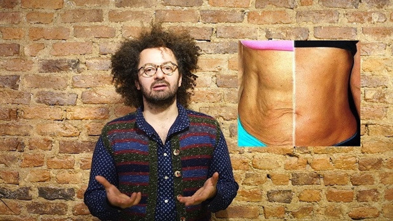 Doktor Bu Ne? | Estetik Dolgu Operasyonu