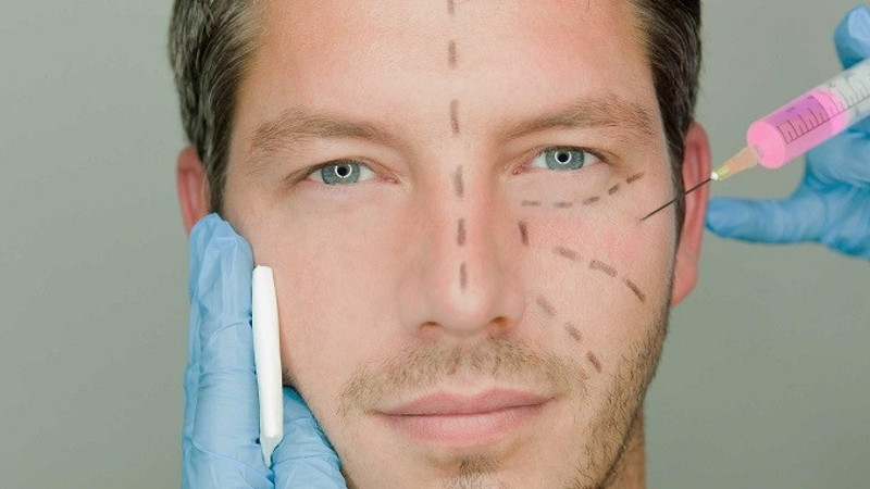 Erkekler arasında yaygın olan 5 popüler estetik uygulaması | Doktor Bu Ne?