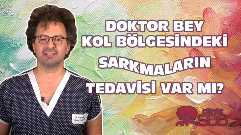 Dikkat Kollar Sarkmasın!