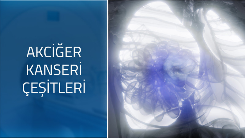 Akciğer kanseri türleri nelerdir?
