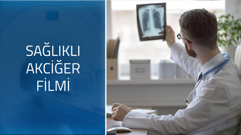 Sağlıklı akciğer filmi nasıl olmalı?