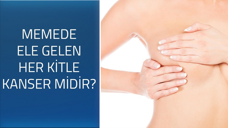 Memede ele gelen her kitle kanser midir?