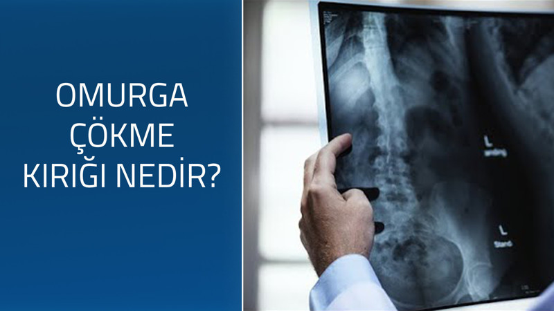 Omurga çökme kırığı nedir?