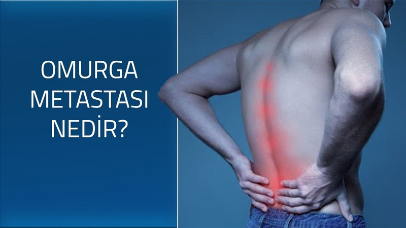 Omurga metastazı nedir?