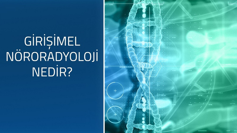 Girişimsel Nöroradyoloji nedir?