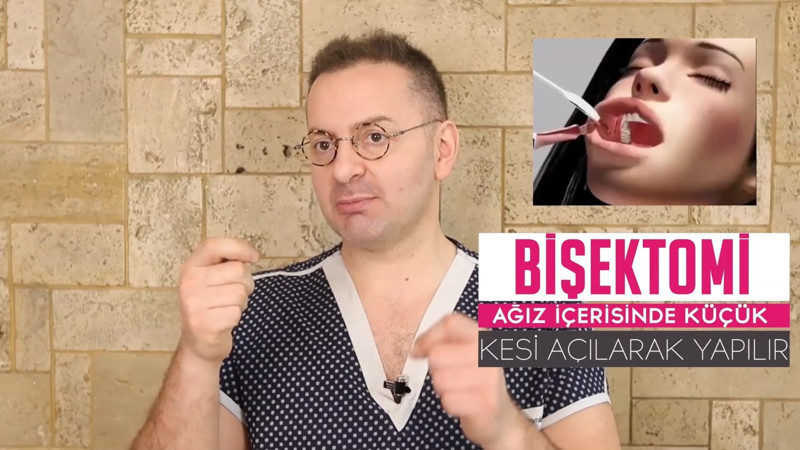 Bişektomi ile Yanak estetiği