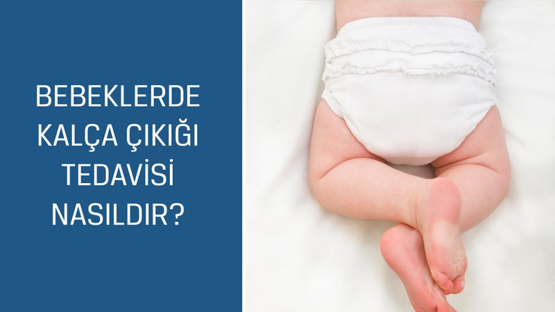 Ortopedi ve Travmatoloji Uzmanı Op. Dr. Ozan Ali Erdal cevaplıyor; Bebeklerde kalça çıkığı tedavisi nasıldır?