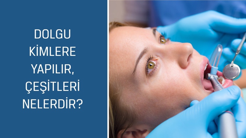 Diş Hekimi Şükrü Kahyaoğlu cevaplıyor; Dolgu kimlere yapılır, çeşitleri nelerdir?