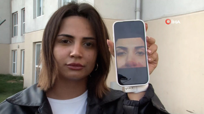 Güzellik merkezinde genç kadının gözüne yapıştırıcı kaçtı: Kör olabilirdim