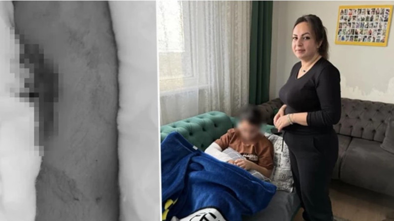 9 yaşındaki &#231;ocuk arkadaşının kolunu iki yerden kırdı!