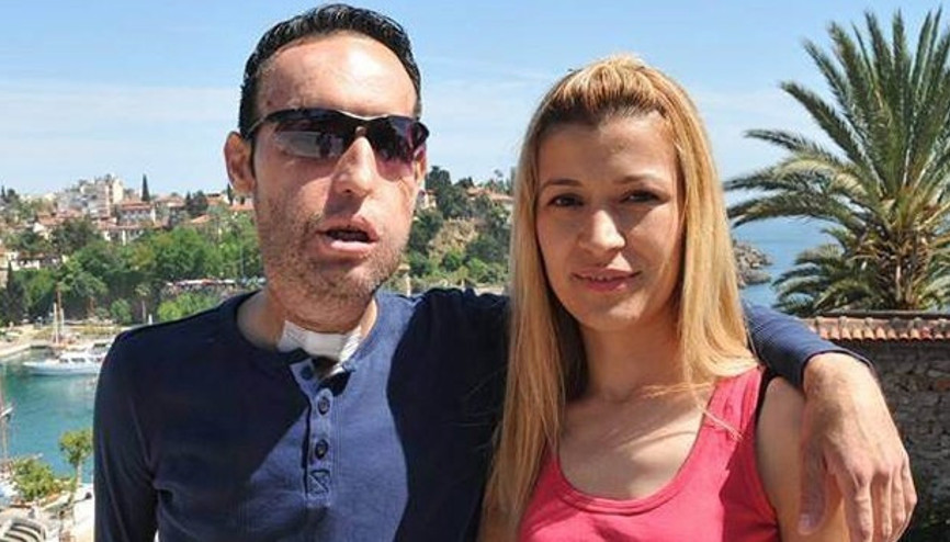 Yüz nakli olan Recep Sert hastaneye kaldırıldı Yüz nakli olan Recep Sert hastaneye kaldırıldı