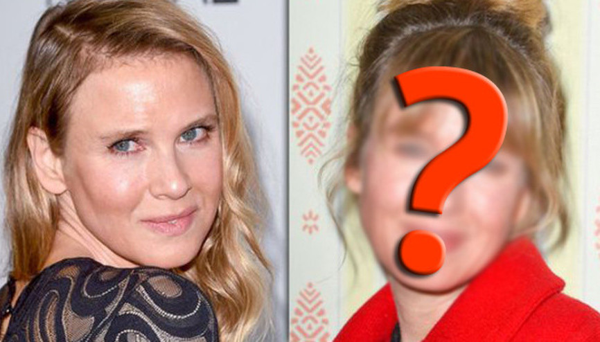 Renee Zellweger eski haline dönmeye başladı