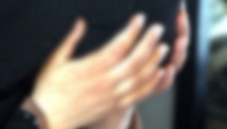 Yemende bir baba nişanlısıyla görüşen kızını yakarak öldürdü