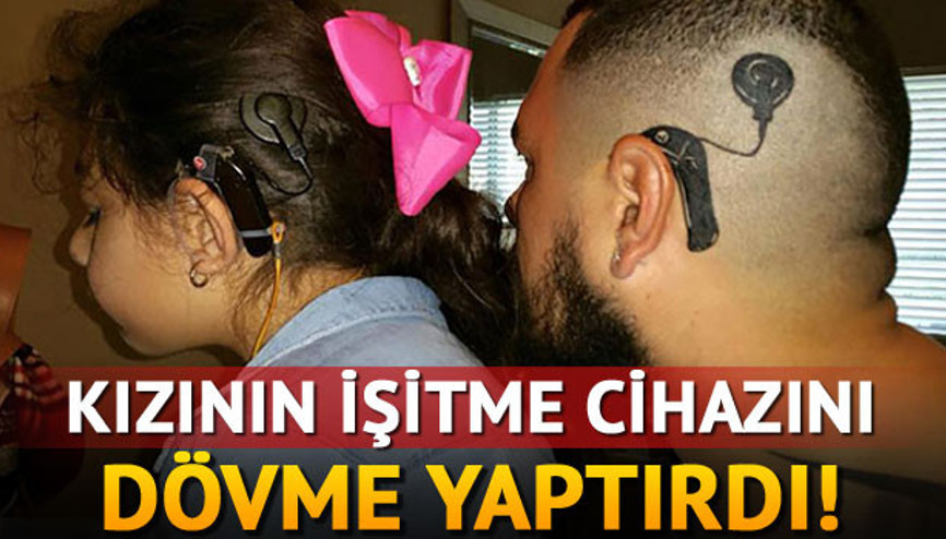 Kızının işitme cihazını dövme yaptırdı
