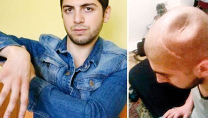 Gürcü gencin kolu ve kafatası kırıldı ama kıran yok