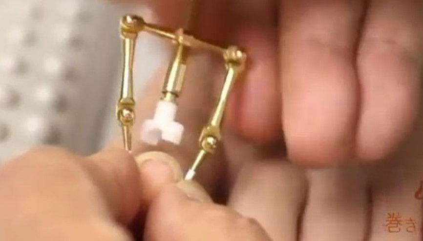 Batık tırnak nasıl düzeltilir