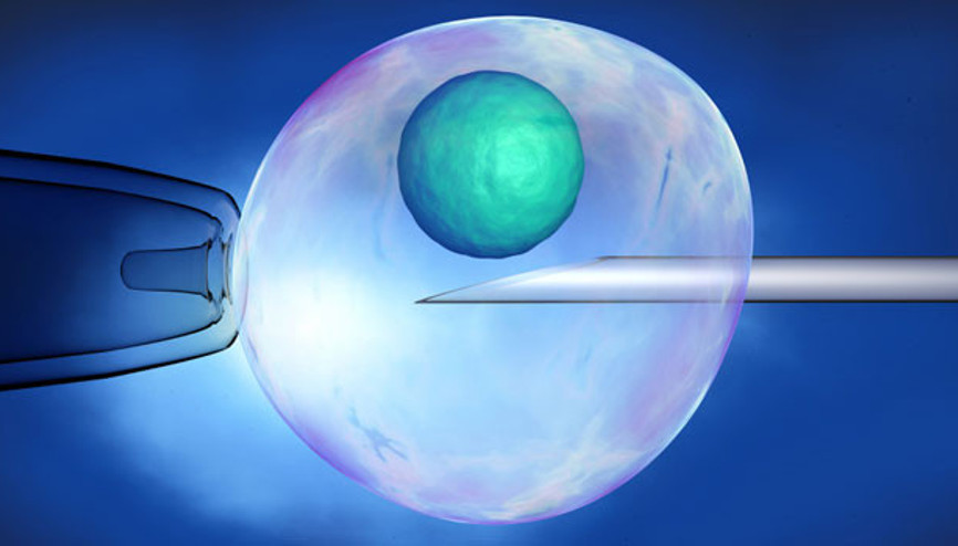 Sperm bankasına öjenik soruşturması
