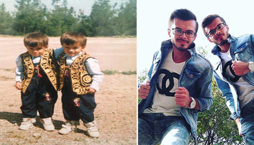 Onları kimse ayırt edemiyor