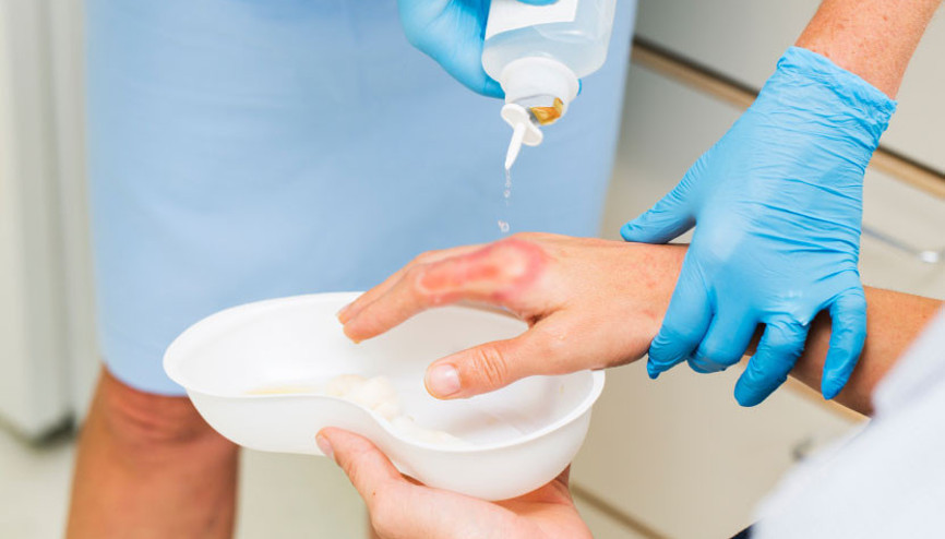 Yanık sonrası oluşan estetik ve fonksiyonel sorunlar