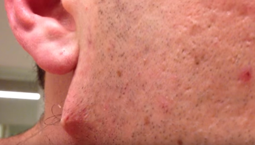 Yüzündeki kıl dönmesini almak isteyince...