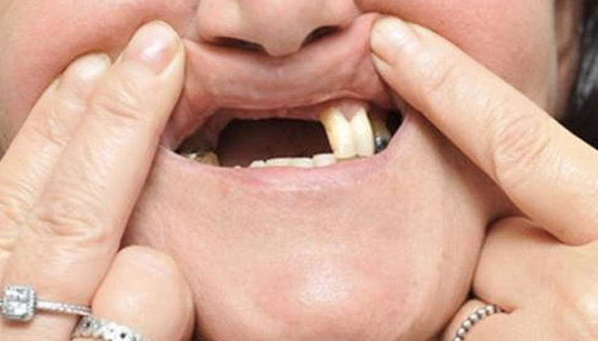 Güzelleşmek için gitti bu hale geldi