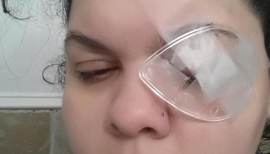 Simli göz farı genç kadını gözünden etti