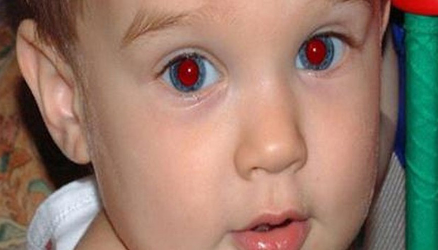 Fotoğraflardaki kırmızı göz etkisine sebep olan şey nedir