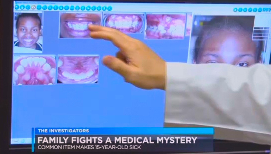 Diş telleri küçük kızı az kalsın öldürüyordu