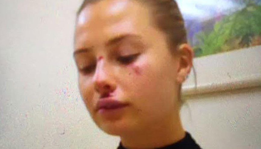 Serdar Ortaçın eşi Chloe bu hale geldi