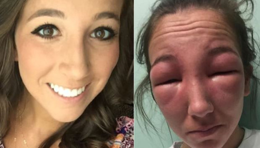 Sarmaşık yüzünden yüzü gözü şişti