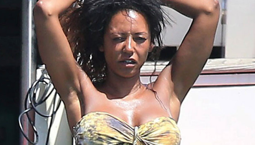 Güneş ona pek yaramadı: Tanıdınız mı bu ünlü şarkıcıyı