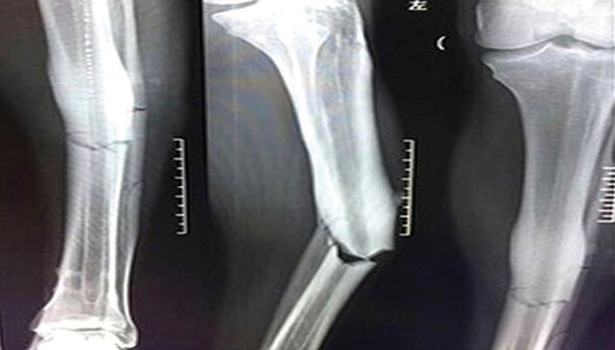 Demba Ba için açıklama Futbol kariyeri bitebilir