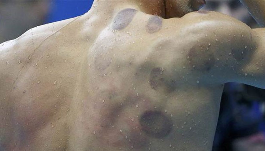 Michael Phelpsten sonra hacamata ilgi patladı