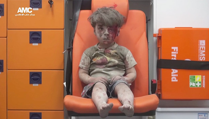 Dünyayı sarsan minik Suriyeli Ümran tek kelime bile konuşmuyor Dünyayı sarsan minik Suriyeli Ümran tek kelime bile konuşmuyor