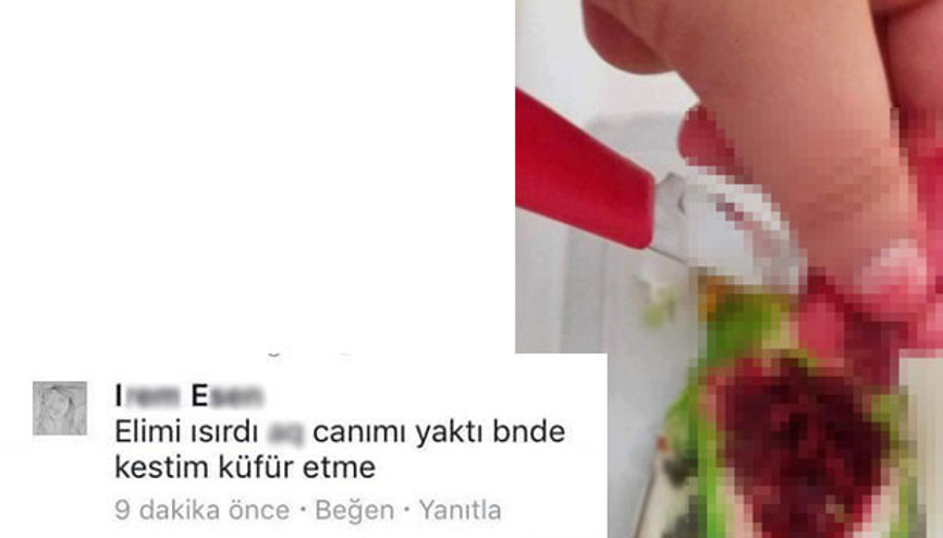 Parmağını ısıran papağanın kalbini söküp Facebooktan paylaştı