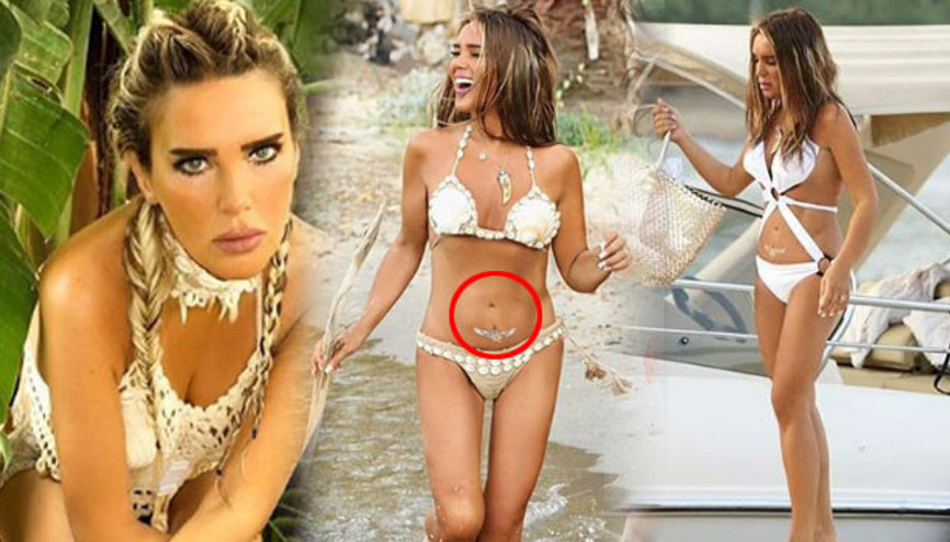 Ameliyattan sonra ikinci göbek deliği oldu