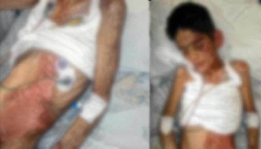 Canavar anne Kocasına benzeyen çocuğuna işkence yaptı Canavar anne Kocasına benzeyen çocuğuna işkence yaptı