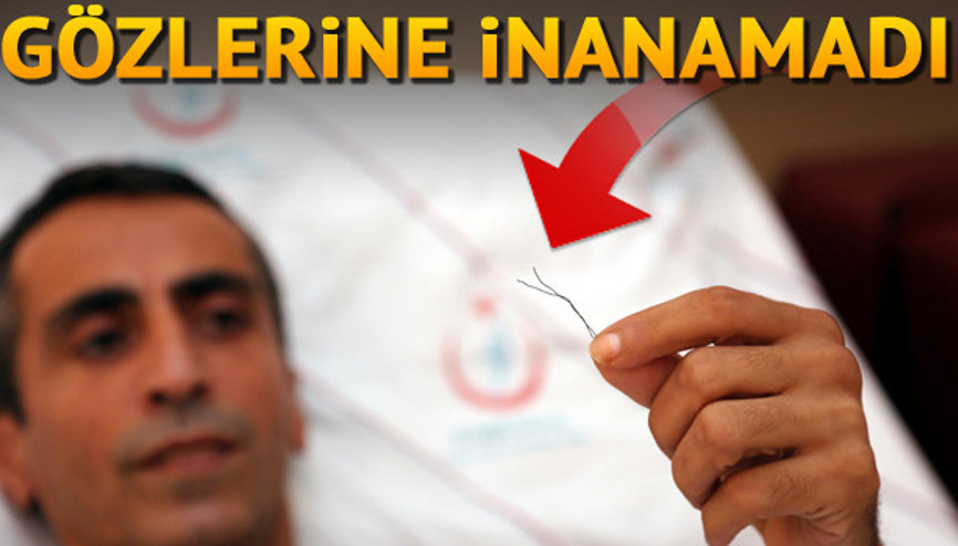 Bağırsağından 10 santimlik tel çıktı