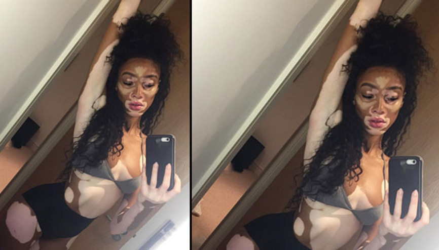 Güzelliğin tanımını değiştirdi