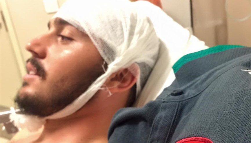 Maçta başına darbe aldı, ölümden döndü